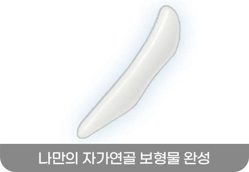 나만의 자가연골 보형물 완성