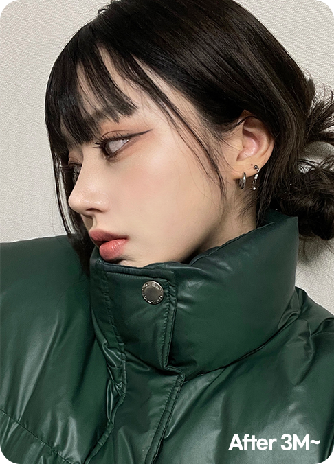 디에이 올아이 리프팅