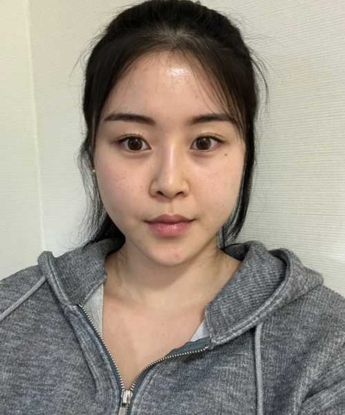 수술 전