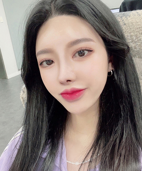 수술 후 3개월