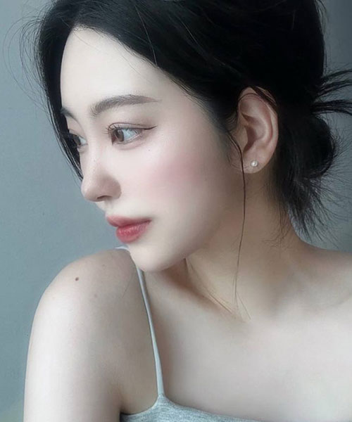 수술 후 5개월