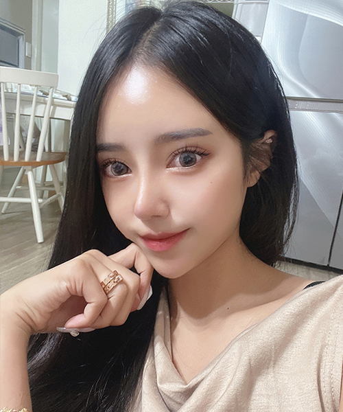 수술 후 3개월