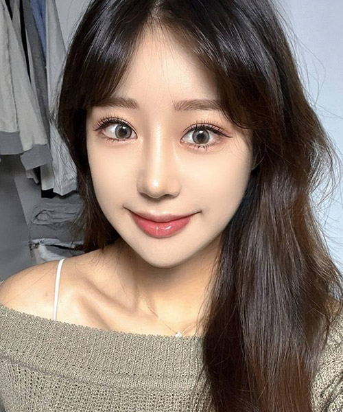 수술 후 1개월