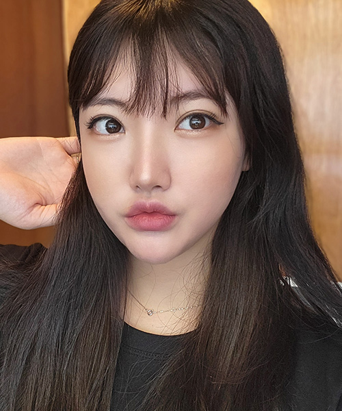 수술 후 3개월