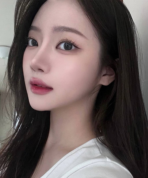수술 후 3개월