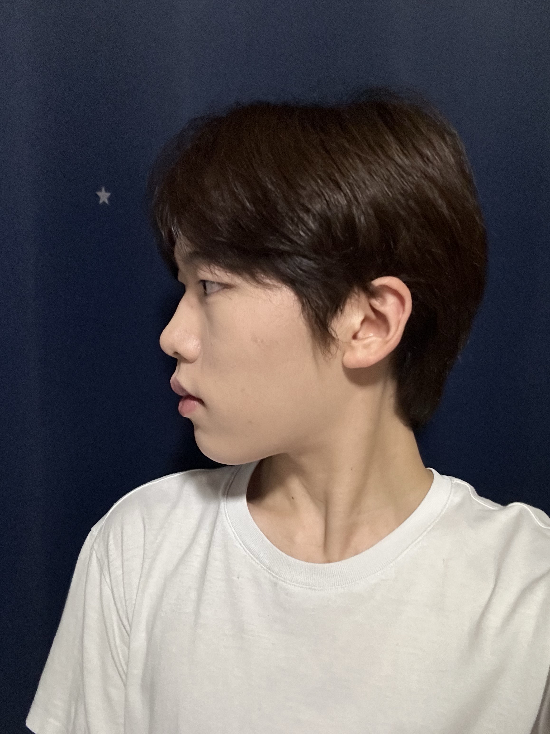수술 전