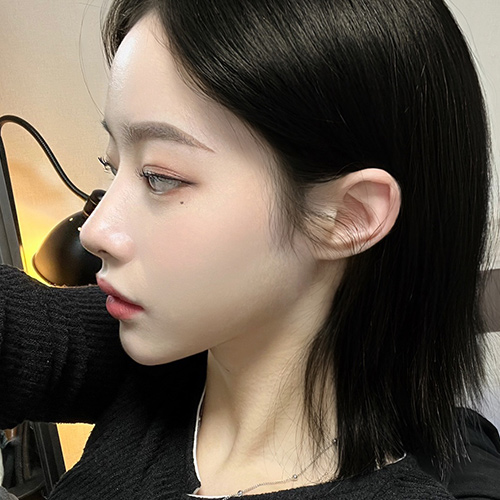 수술 후 1년