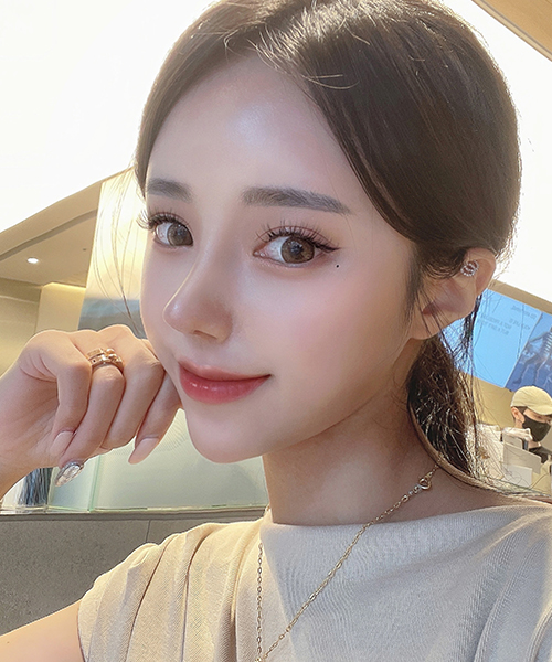 수술 후 1개월