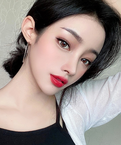 수술 후 2개월