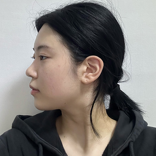 수술 전
