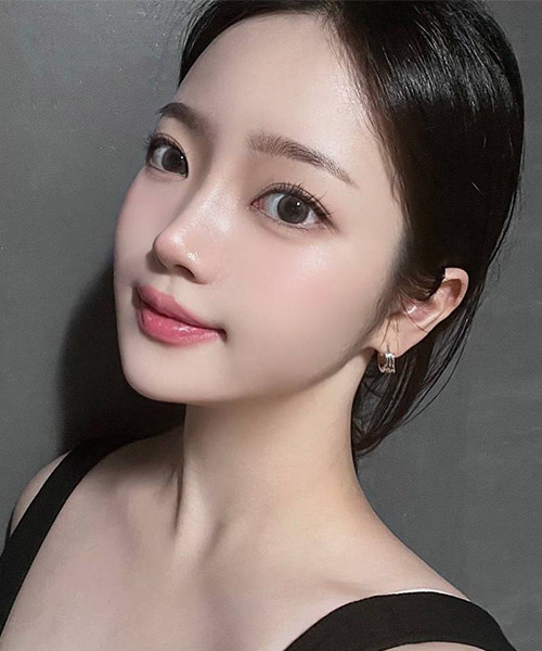 수술 후 2개월