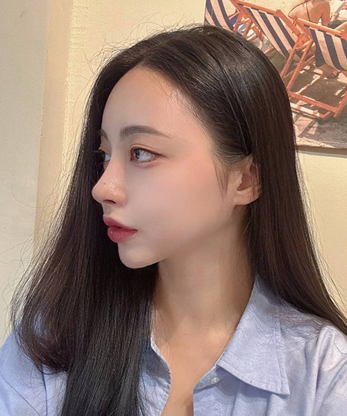 수술 후 3개월